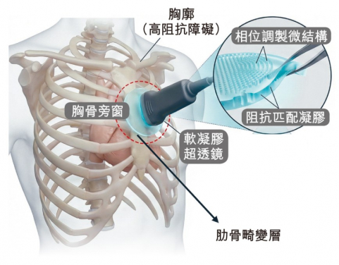 「動態控制超透鏡」技術可直接透過肋骨取得完整、實時且高解像度的心臟影像。